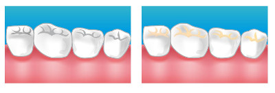 orthodontie aubagne
