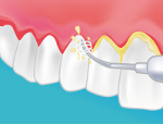 dentiste aubagne